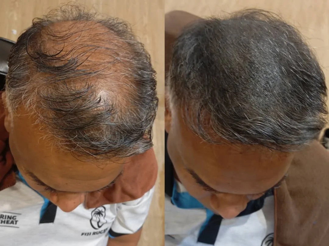 Anggun Pakar Rambut client, before and after