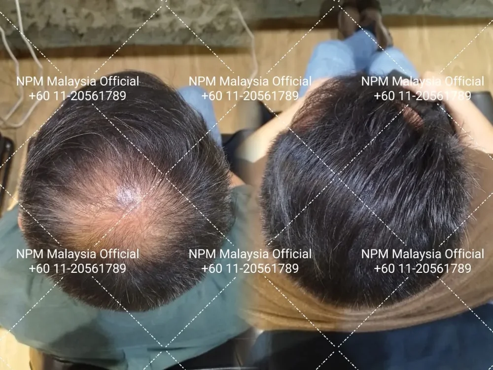 Before / after · shared with client permission