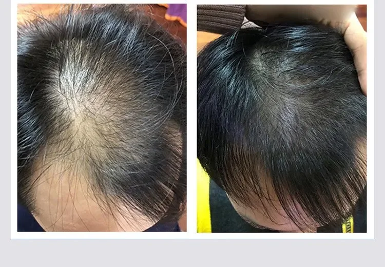 Another NPM Malaysia SMP client, before and after