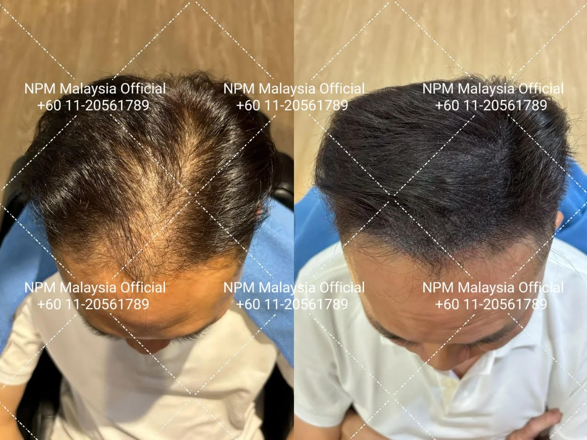 NPM Malaysia client, before and after