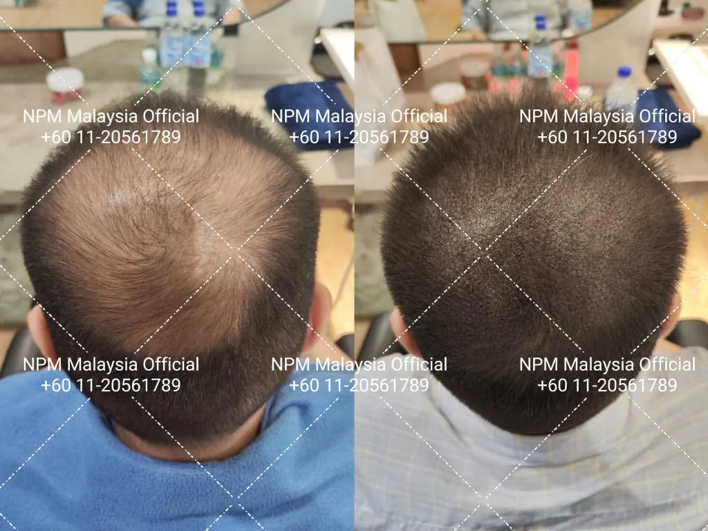 NPM Malaysia client, before and after